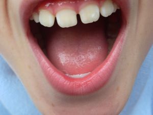 Krzyk